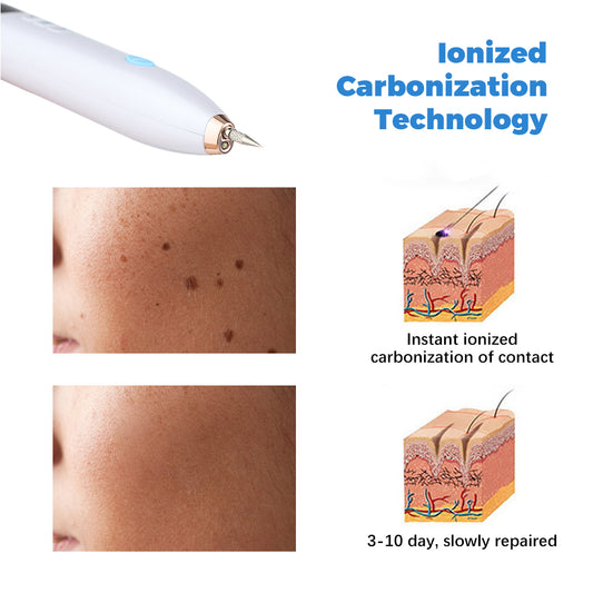 Laser Skin Tag Remover Face Mole Remove Plasma Pen - last minute health and beauty