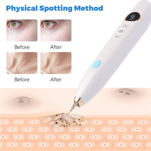 Laser Skin Tag Remover Face Mole Remove Plasma Pen - last minute health and beauty